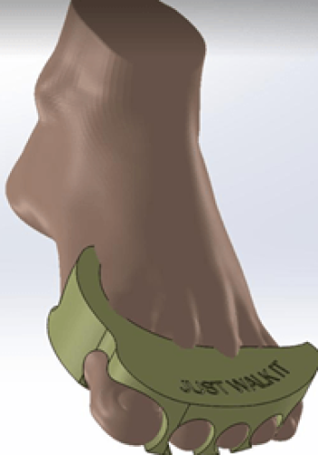 Comprehensive Orthopedic Solutions (Femur Implant, Fracture Repair, Hallux Valgus) 2